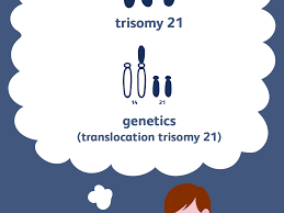 Down Syndrome Causes And Risk Factors