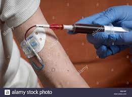 Drawing Blood From A Picc Line With Surgical Gloves (Peripherally Inserted  Central Catheter Stock Photo - Alamy