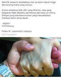 (ini orangnya yang kamu maksud mau kuliah tapi tidak punya biaya?) tanya seseorang yang baru saja keluar dari kamarnya dengan perawakan tinggi besar, perut gendut dengan warna kulit agak hitam. Urat Tangan Hijau Penyebab Medical Mythbusters Malaysia Facebook