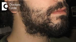 What Causes Patches On Beard In 23 Year Old Its Management Dr Aruna Prasad Youtube