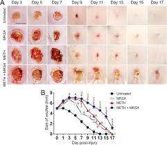 Maybe you would like to learn more about one of these? Methamphetamine Alters The Antimicrobial Efficacy Of Phagocytic Cells During Methicillin Resistant Staphylococcus Aureus Skin Infection Mbio