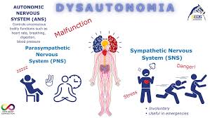 Image result for Autonomic Dysfunction