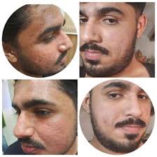 192 Reviews for Shree Sharma Dental Skin Hair Clinic in Gandhi Nagar,  Neemuch