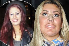 Chloe ferry was born on 31 august 1995. Shocking Before And After Pictures Show Chloe Ferry S Extreme Transformation As Fans Beg Her To Stop The Surgery Mirror Online