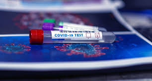 Bukmacherzy przed startem euro 2020 najwyżej oceniali szanse reprezentacji francji. Aktualizacja Kierowcy Przyplywajacy Z Irlandii Do Francji Musza Okazac Wynik Testu Na Covid 19 Zobacz Gdzie Zrobic Test Trans Info