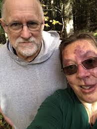 Patricia Lipe's Instagram, Twitter & Facebook