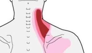 Stiff And Slow When Rising From Seated Position Integrative Works Shoulder Tension Headache Trigger Points Neck