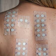 Image result for Patch Testing