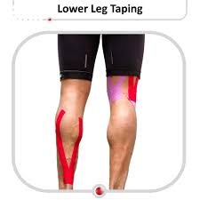 Image result for Taping for Soleus and Achilles