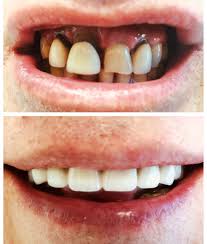 Friendly, professional and very easy to talk to. Cosmetic Dentistry Dover Aesthetic Dental Center Of Morris County