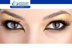 See the before/after results here. Cat Eye Surgery In Iran Cat Eye Surgery Canthoplasty Iranian Surgery