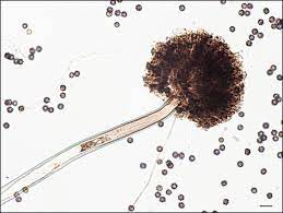 Pin En Aspergillus