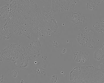 DLD-1 Epithelial Morphology Profiling, AI generated
