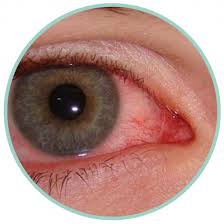 Image result for Blepharis gazensis