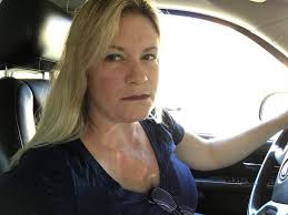 I just got fillings done in my front teeth, so my upper lip is numb, and I  feel like the 2-faced girlfriend 🤣