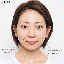 肌アイロン before 肌 美容 小顔マッサージ
