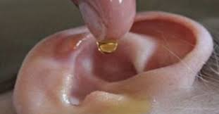Ohrensausen 11 Hausmittel Gegen Tinnitus Http Stories24 De Ohrensausen 11 Hausmittel Ge Ear Infection Home Remedies Ear Infection Remedy Cold Home Remedies