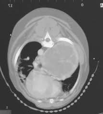 Lung cancer accounts for about one percent of all cancers in dogs. Thoracic Tumors Lung Dr Julius Liptak