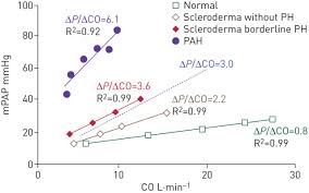 Pathophysiology Of The Right Ventricle And Of The Pulmonary