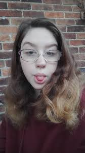 FIF my name is Gabe and this is me 2.5 weeks