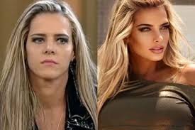 Denise Rocha comenta sobre possíveis novos procedimentos no rosto