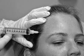 Image result for Forehead Regional Block