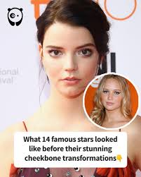 What 14 famous stars looked like before their stunning cheekbone  transformations (link in the comments)