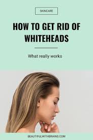 Maybe you would like to learn more about one of these? How To Get Rid Of Whiteheads Causes And Treatments