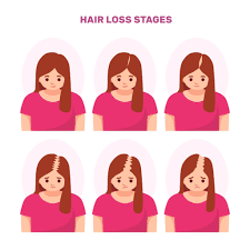 Taking large amounts of vitamin a or selenium is also toxic and can cause hair loss. Hair Loss In Females The 2 Most Common Causes Saikia Skin Care