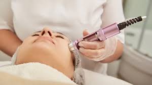 Microneedling San Antonio: A Complete Guide to Smooth, Radiant Skin