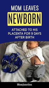 Mom Leaves Newborn Son Attached To His Placenta For 9 Days After Birth It Worked Itself Out Beautifully Circumcision Care Newborn Placenta Newborn Care
