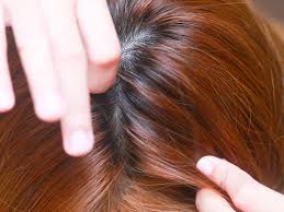 Brands of hair dye that may be effective in killing head lice include: 4 Ways To Prevent Head Lice Wikihow