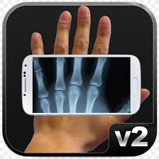 Try the latest version of xray photo 2016 for android. Xray Scanner Prank X Ray Scanner Prank Android X Ray Cloth Scan Camera Prank Png 1024x1024px