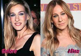 Despite clear unusual face look, parker insists that she has never had aesthetic surgery. Sarah Jessica Parker Before And After Surgery Procedure Beauty Works Hair Extensions Beauty Works Beauty