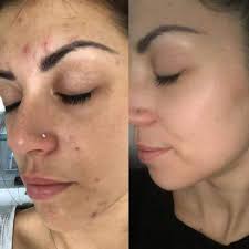 Schönheitssalon, Beautysalon Rheinfelden (Aargau)