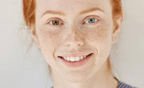 Everything you wanted to know about pigmentation