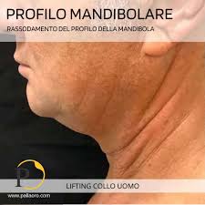 Come rassodare la linea mandibolare?