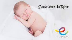 Sindrome De Rett Actividades Para Paliar Sus Efectos En Ninas Desarrollo Del Bebe Recien Nacido Bebe