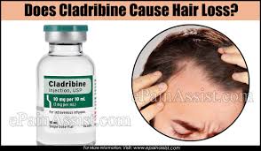 There are a number of possible side effects that may occur with hydrochlorothiazide, and hair loss has been a reported problem. Does Cladribine Cause Hair Loss