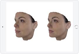 Previous set of related ideas. Crisalix Vr 4d 3d Plastic Cosmetic Surgery Simulator Software