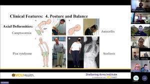 Rehabilitation for Parkinson disease