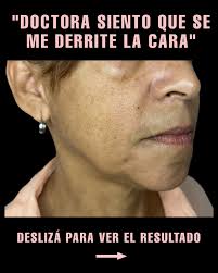 Dra Florencia Barraza