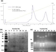We did not find results for: Elution Profile Of Hitrap Q Hp Column Chromatography A Sds Page Of Download Scientific Diagram