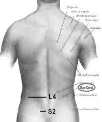 Psis — can refer to a number of different things:*police station information system, a british police computer system *posterior superior iliac spine, part of the human hip bone *programme for strategic. Pain Management Psis Injection