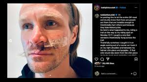 A Wire Trap Nearly Took a Rider's Head Off, Others Chimed In With Similar  Stories