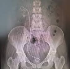 If you have an emergency that requires the police, you should call the emergency number 112. Jabatan Urologi Hospital Serdang Home Facebook