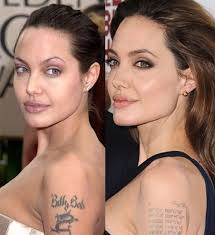 Has Angelina Jolie Gotten Plastic Surgery Angelina Jolie Plastic Surgery 2013 Before And Angelina Jolie Plastic Surgery Angelina Jolie Nose Job Face Fillers