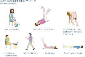 知ってください下肢静脈瘤のこと 下肢静脈瘤の治療法 静脈瘤 治療 足の痛み