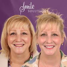 Hi I'm Casey. I've been working as a general dentist for 10 years and at  Smile Solutions for the last 6. I love the variety each day brings in  general dentistry, from