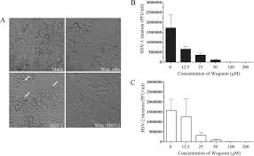 The photos of hsv 2 pictures below are not recommended for people with a weak psyche! Wogonin Inhibits In Vitro Herpes Simplex Virus Type 1 And 2 Infection By Modulating Cellular Nf Kb And Mapk Pathways Bmc Microbiology Full Text